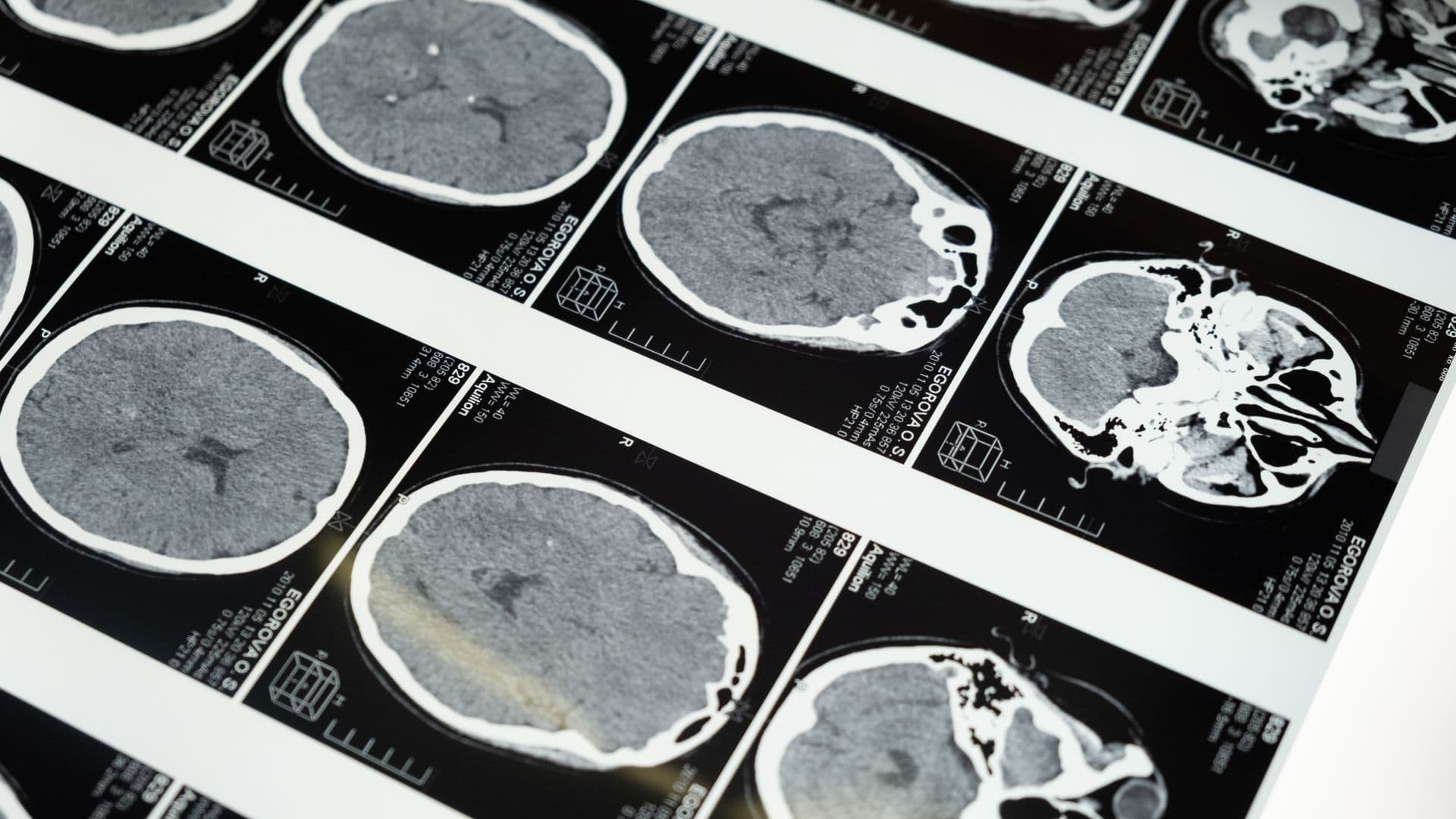 Eeg brain research lab
